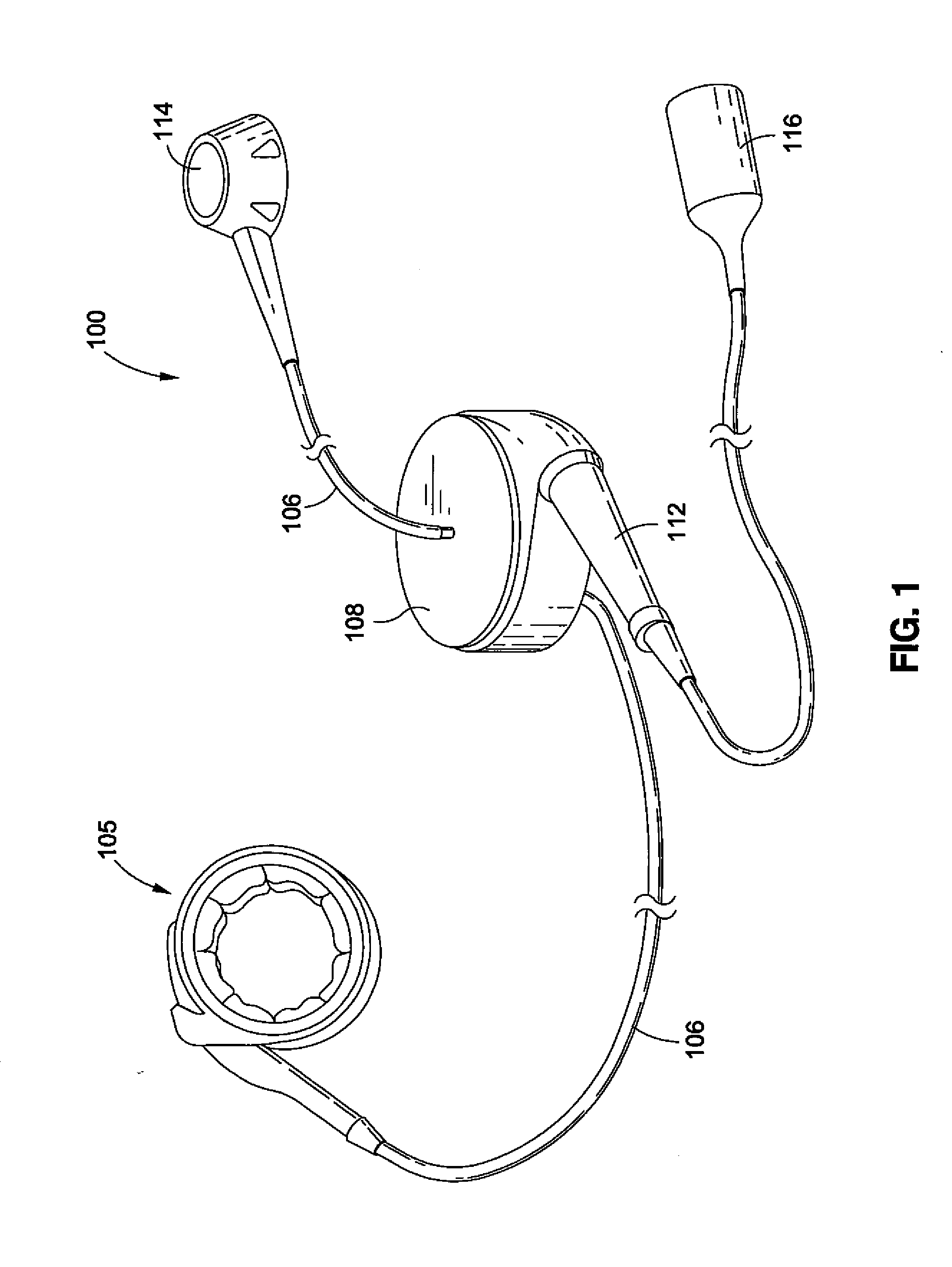 Remotely adjustable gastric banding system