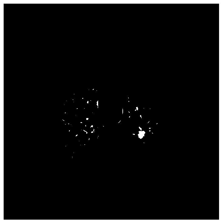 lung CT image nodule screening method based on generalized S transformation and Teager attributes