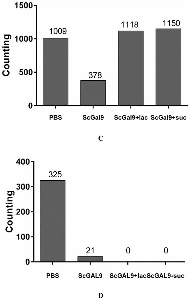 Application of a kind of galectin-9 derived from mandarin fish in the preparation of antibacterial agent