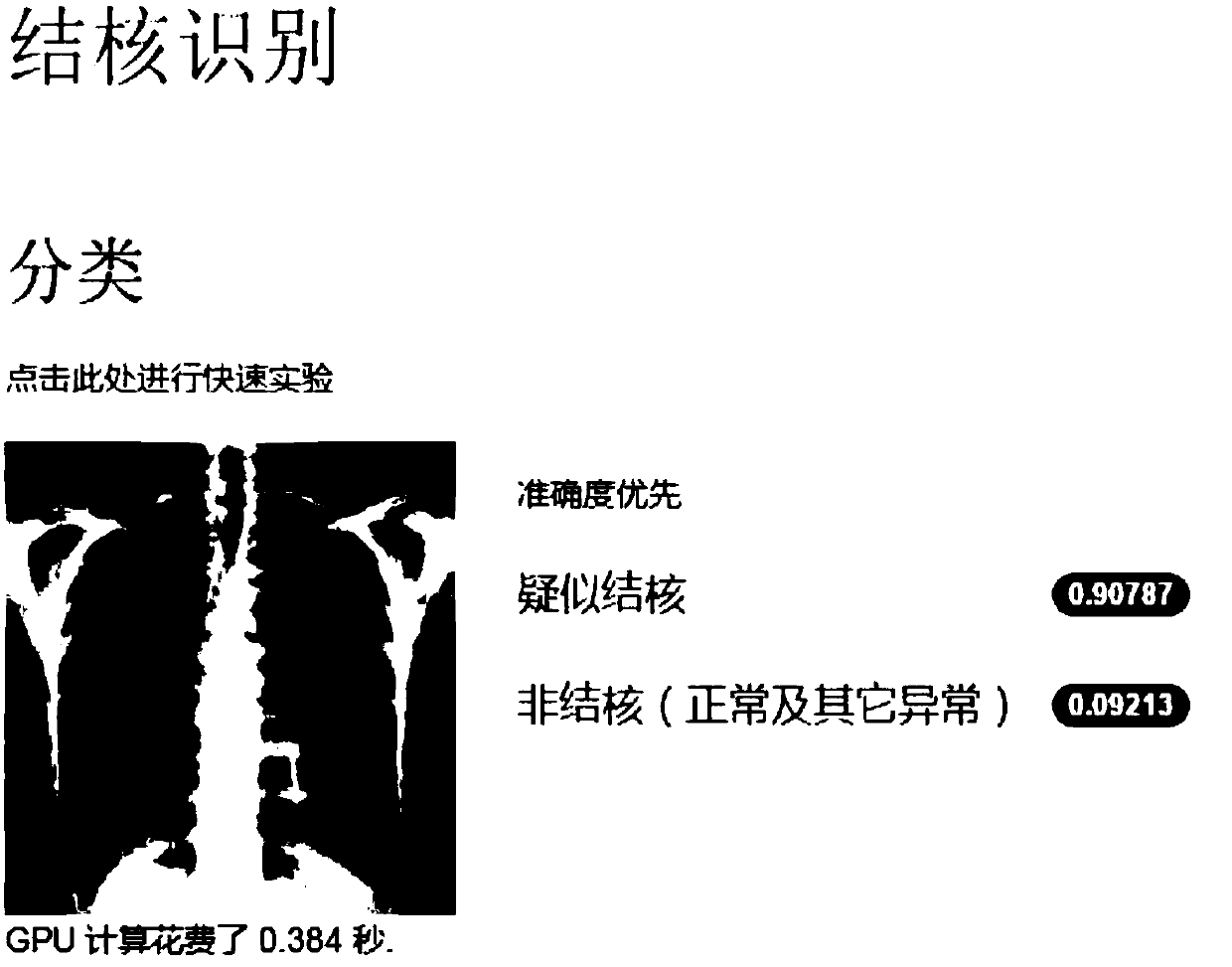 DR-based pulmonary tuberculosis intelligent identification method and system