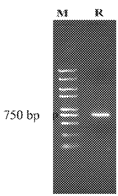 Broad spectrum of <i>Streptococcus </i>lyase and use thereof