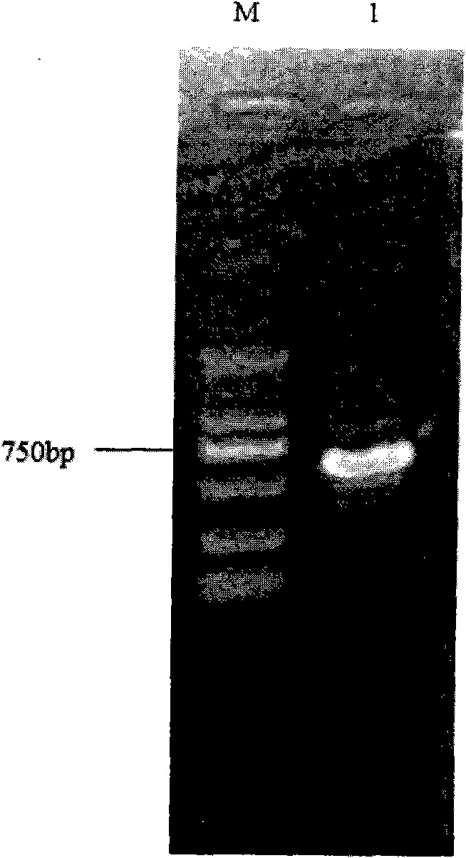 Preparation method of water-soluble human collagen VI polypeptide