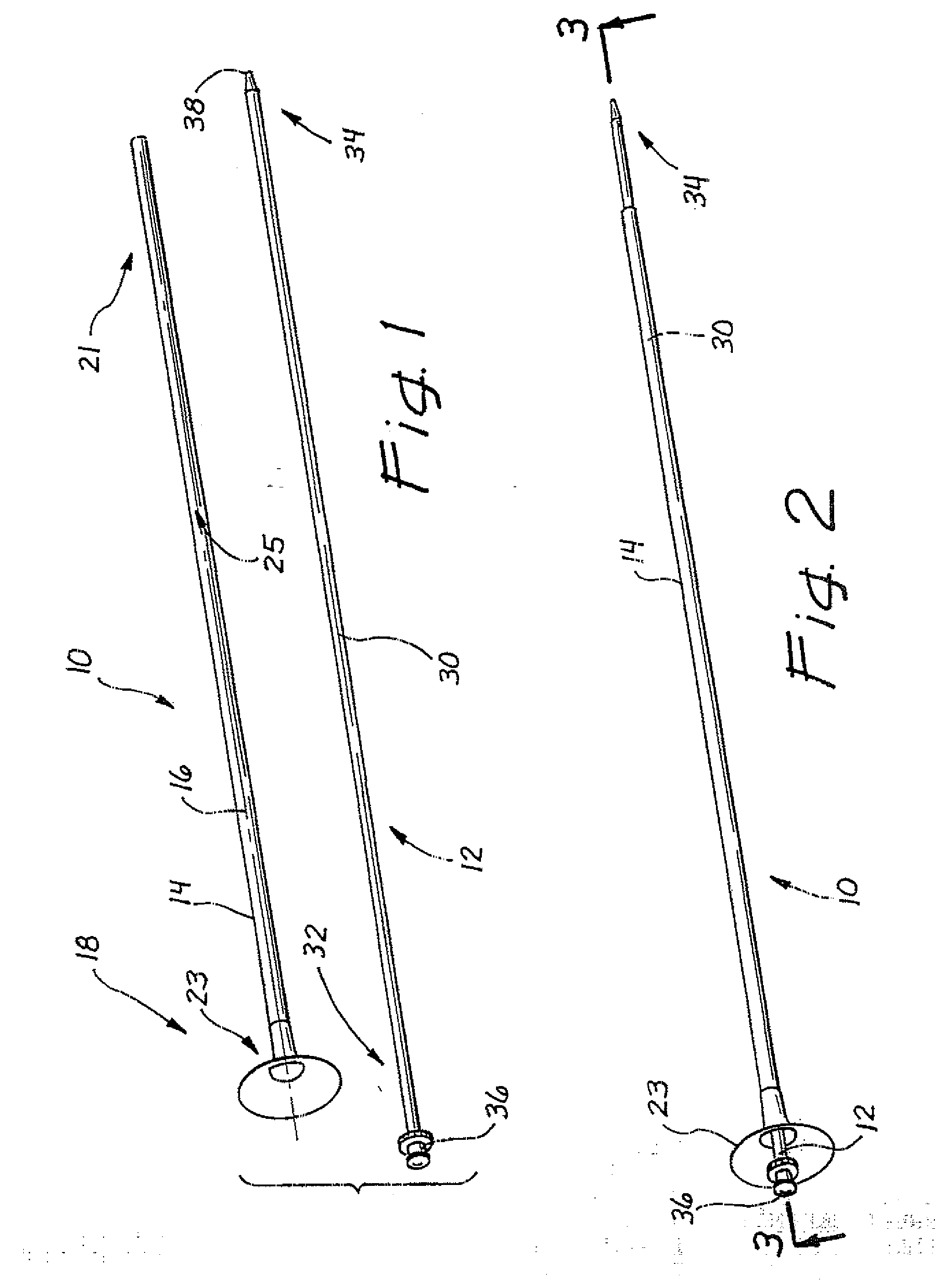 Ureteral access sheath