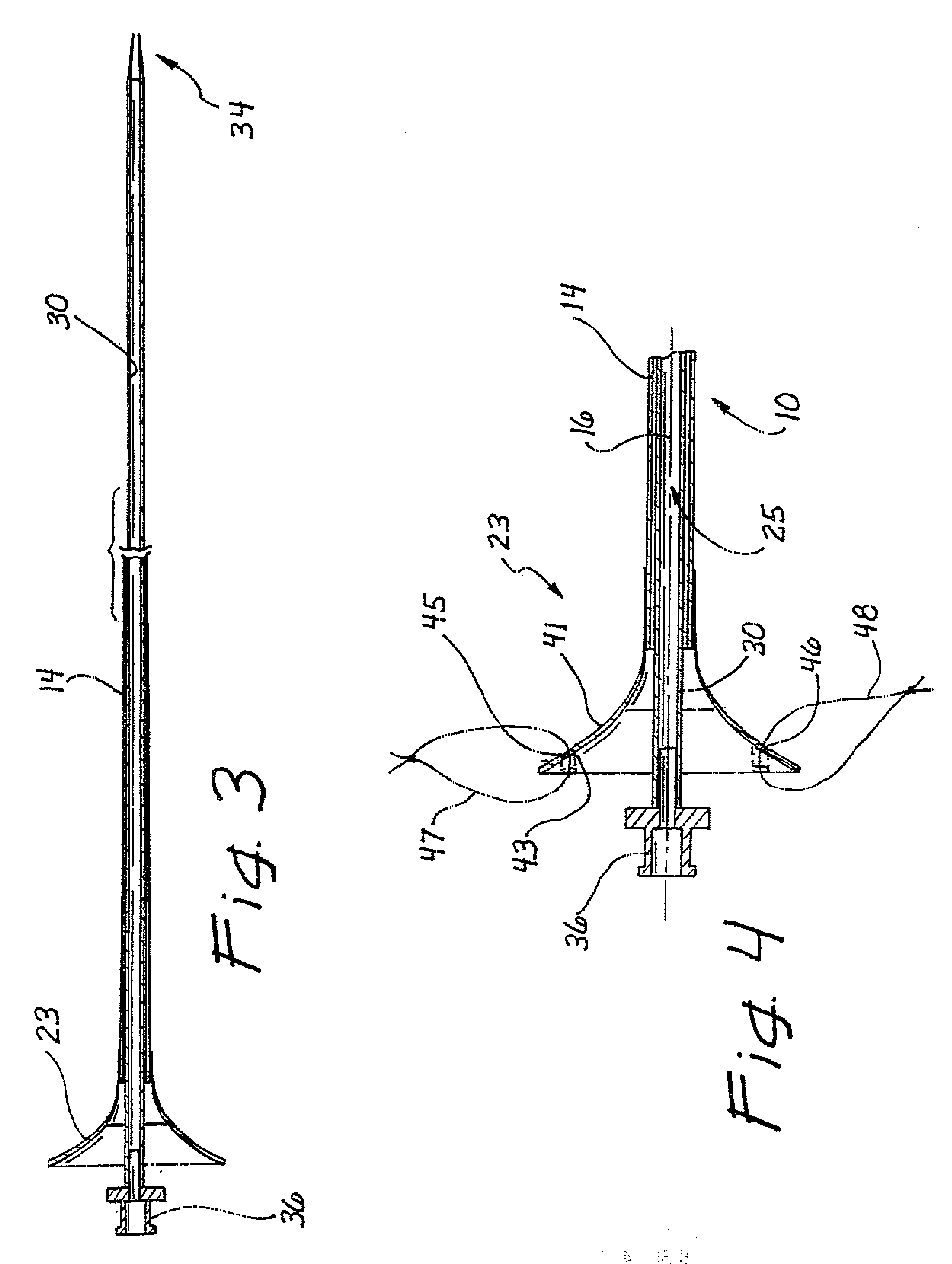 Ureteral access sheath