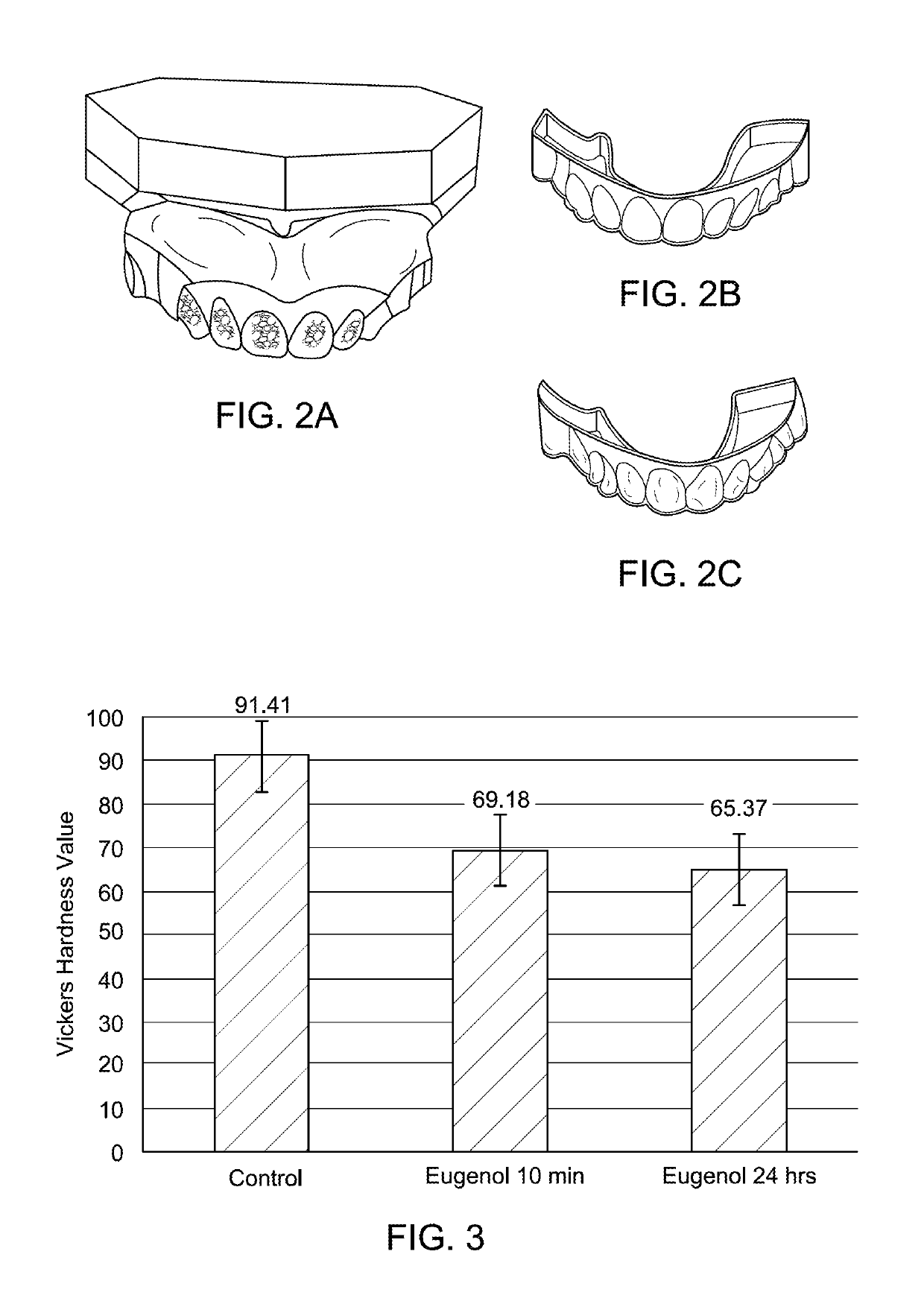 Method for debonding of orthodontic metal brackets with eugenol emulgel