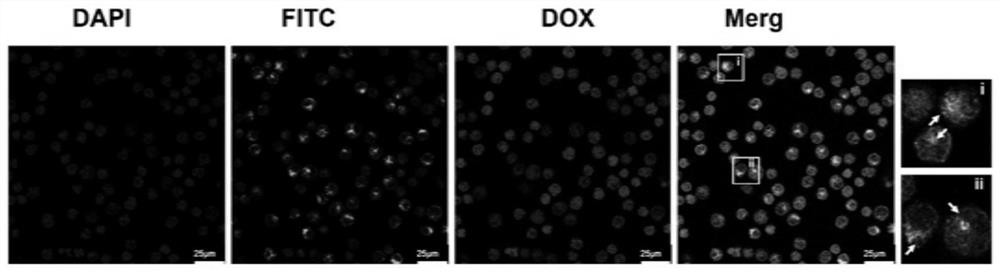 A kind of exosome targeting lymphoma cells and its preparation method and application