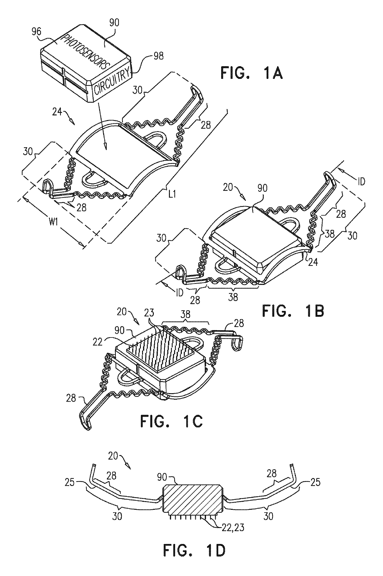 Retinal implant fixation