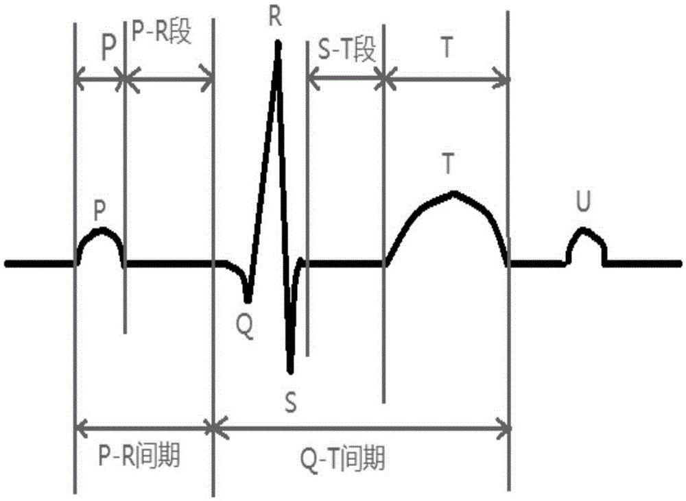 R wave rapid detection method adaptive to electrocardiogram waveform pathological change