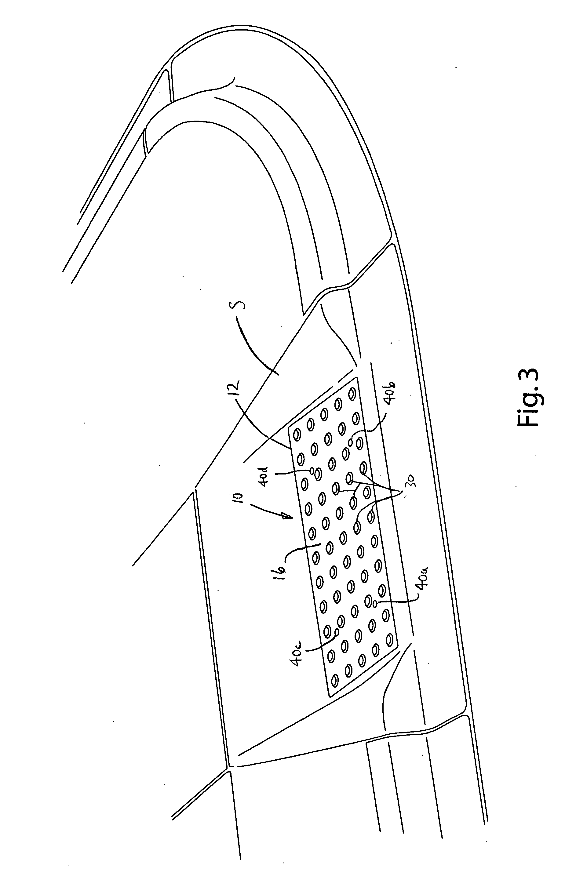 Detectable warning plate