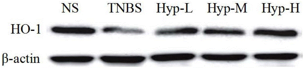 Application of hyperin to treatment of ulcerative colitis