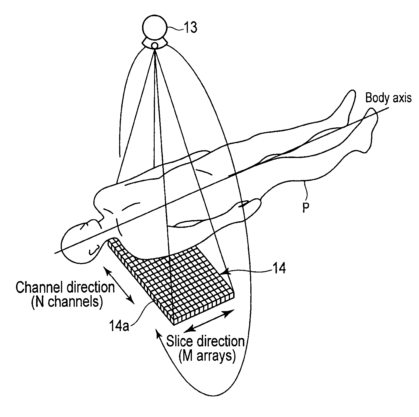 X-ray CT apparatus and image processing apparatus