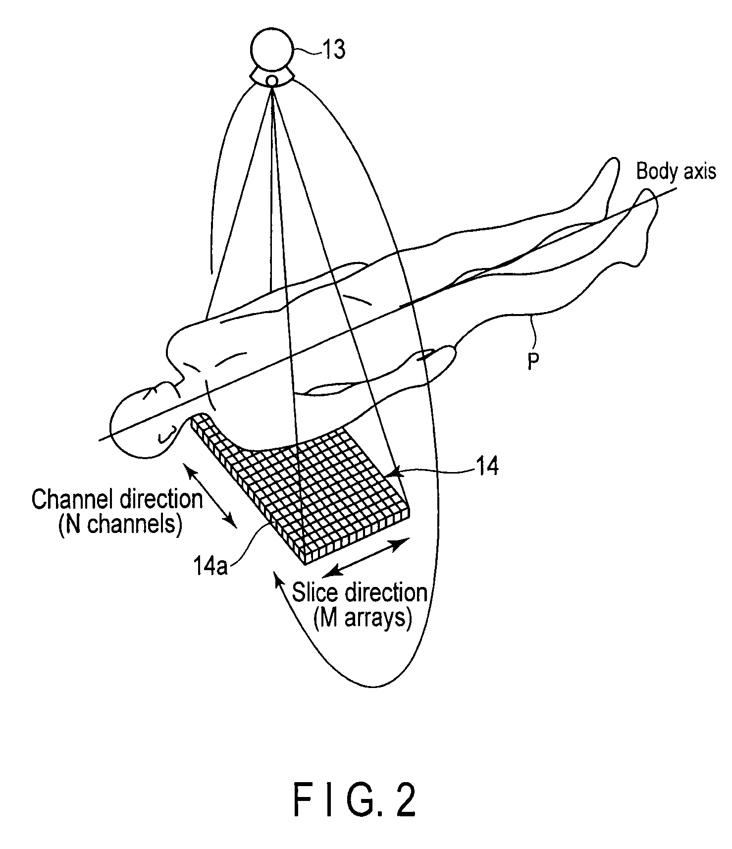 X-ray CT apparatus and image processing apparatus