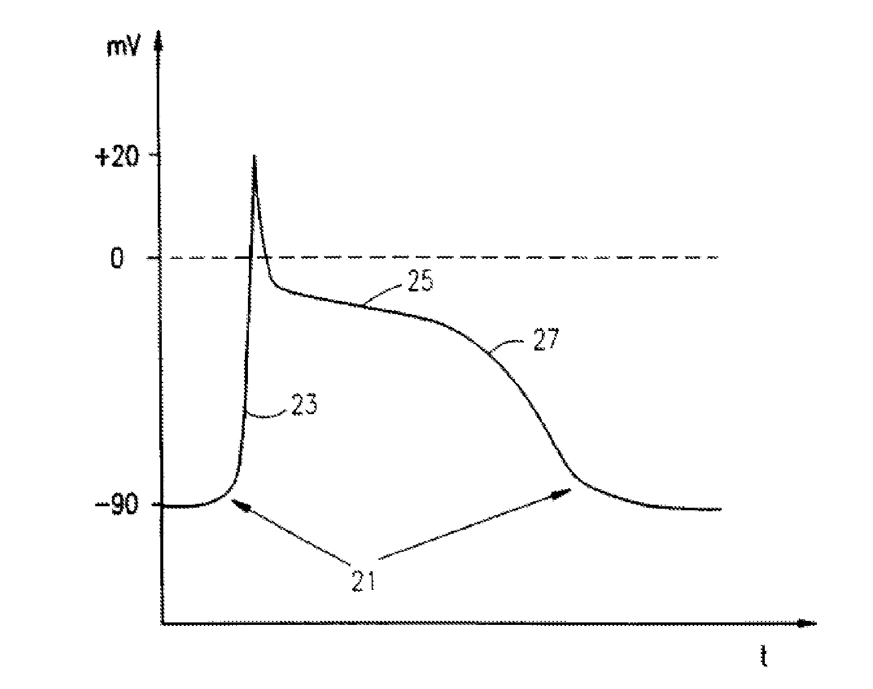 Electrical muscle controller and pacing with hemodynamic enhancement