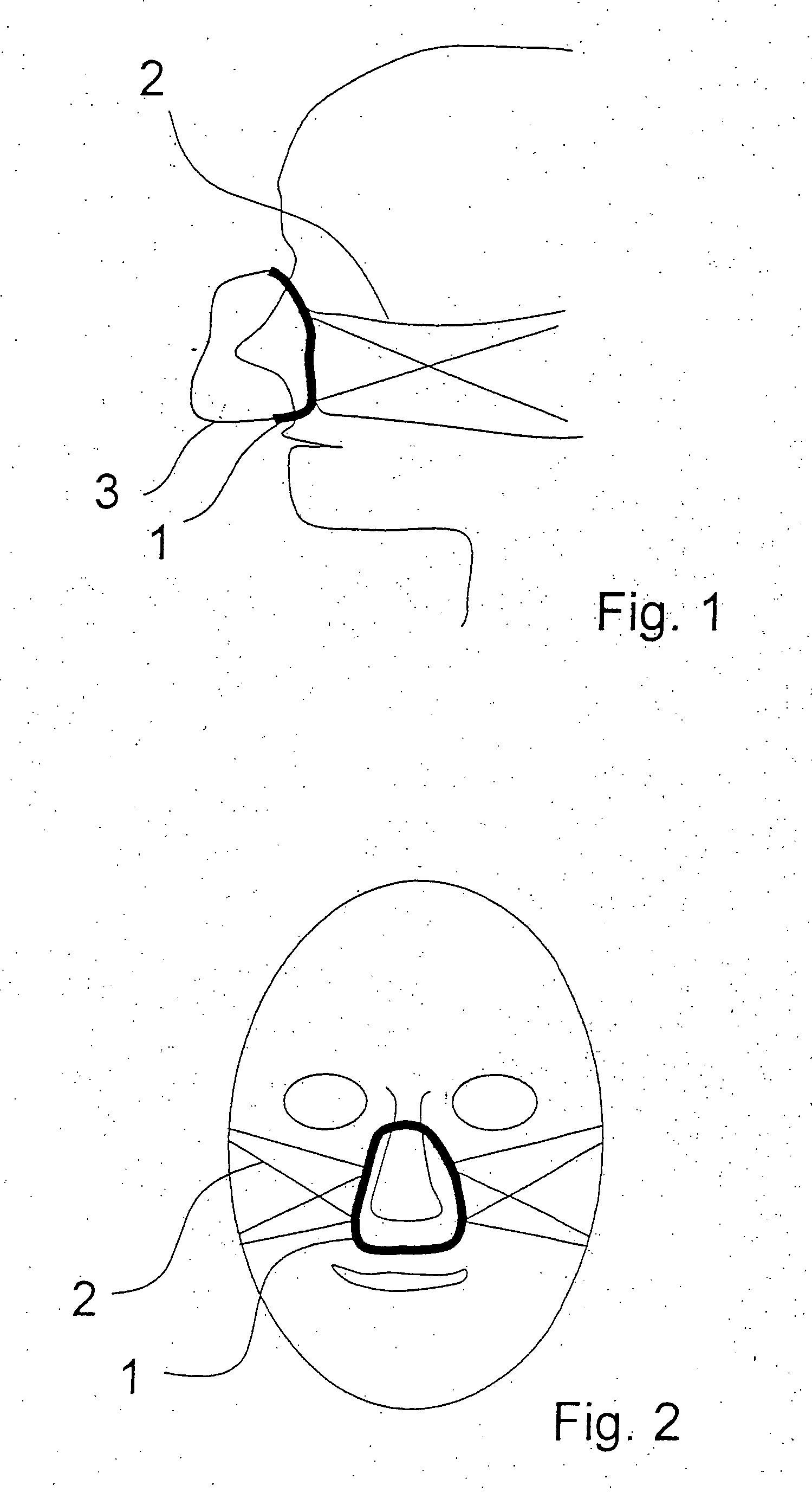 Breathing mask with an adhesive seal