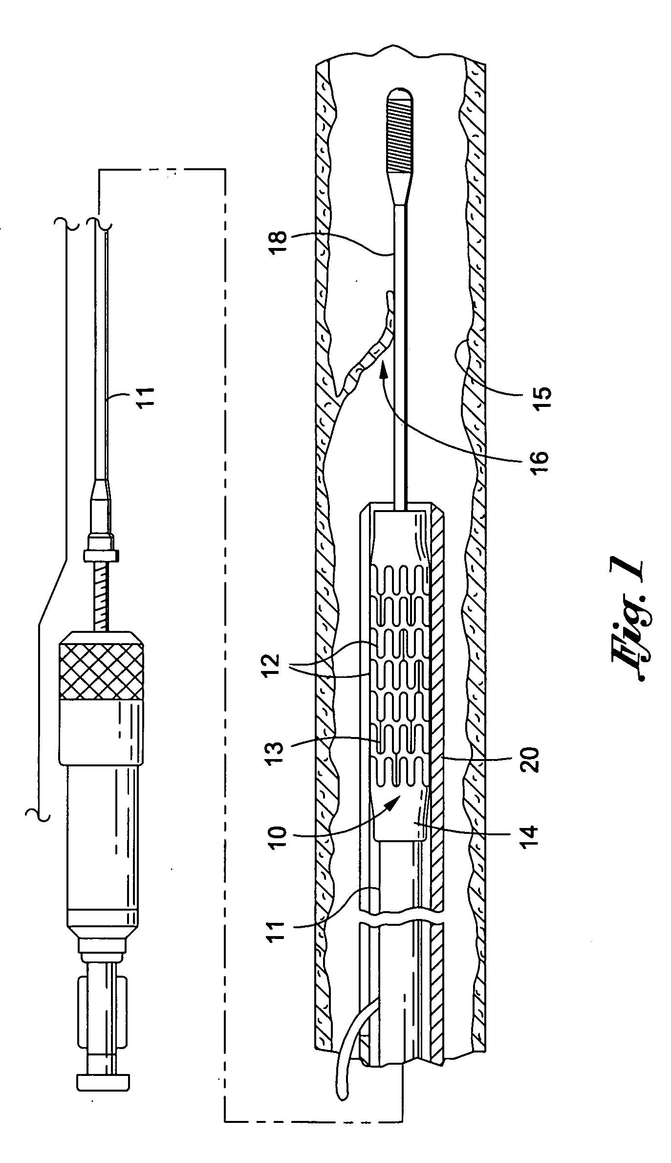 Stent crimping device