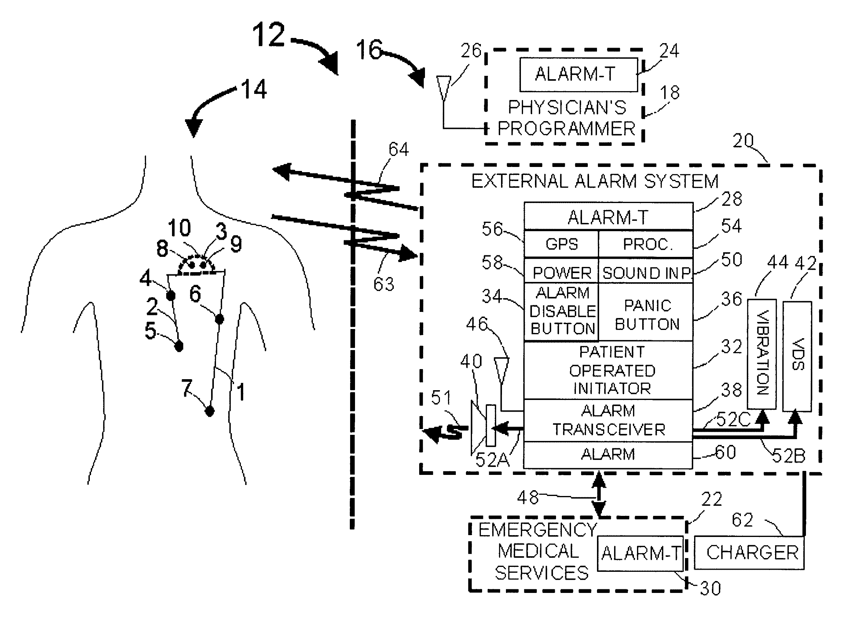 Systems and methods of alarm validation and backup in implanted medical devices