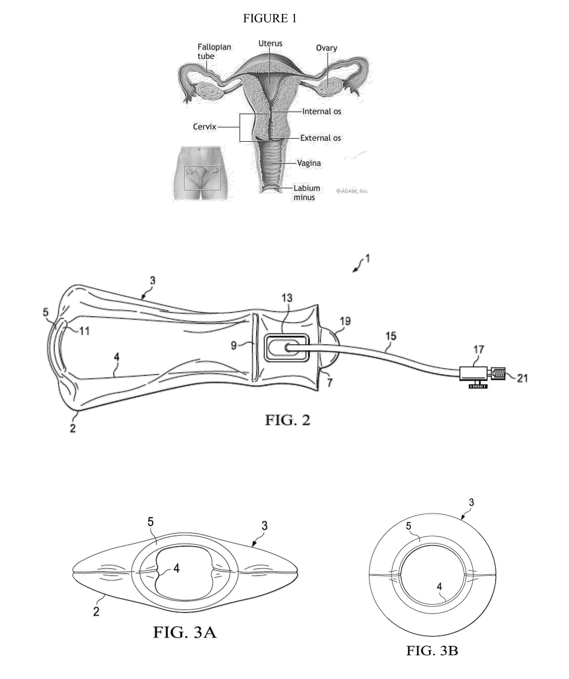 Universal balloon for brachytherapy applicator