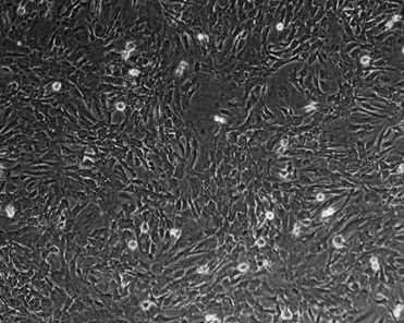 Methods for in vitro isolation and culture and induced differentiation of bovine muscle satellite cells