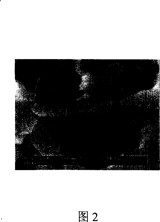 Nano lanthanum carbonate and orally disintegrating tablet and preparation method