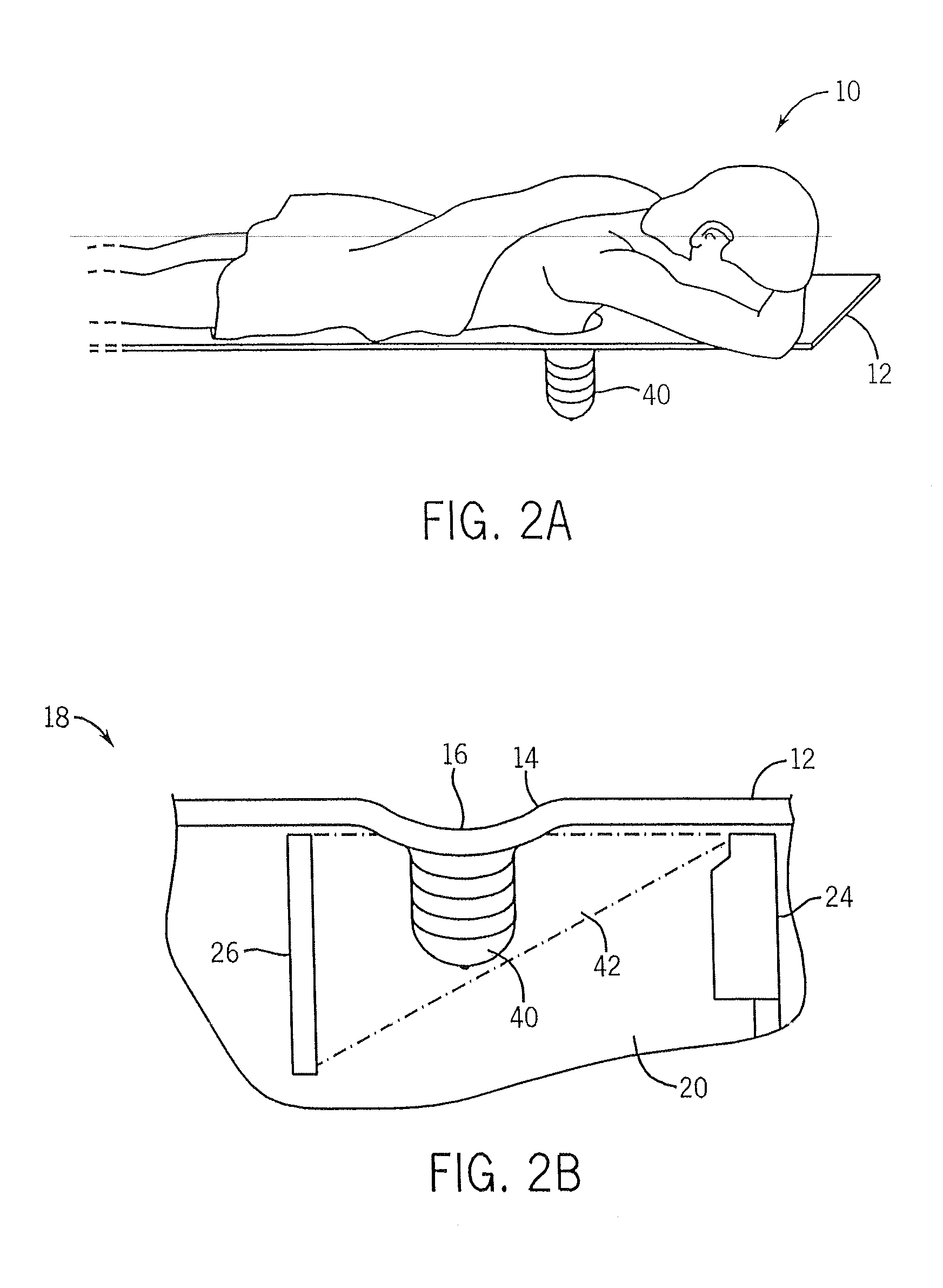 Biopsy Systems For Breast Computed Tomography