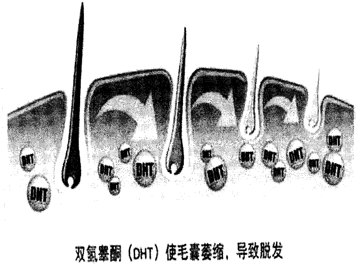 Production technique and application of follicular cell activator-containing anti-hair loss restoring preparation