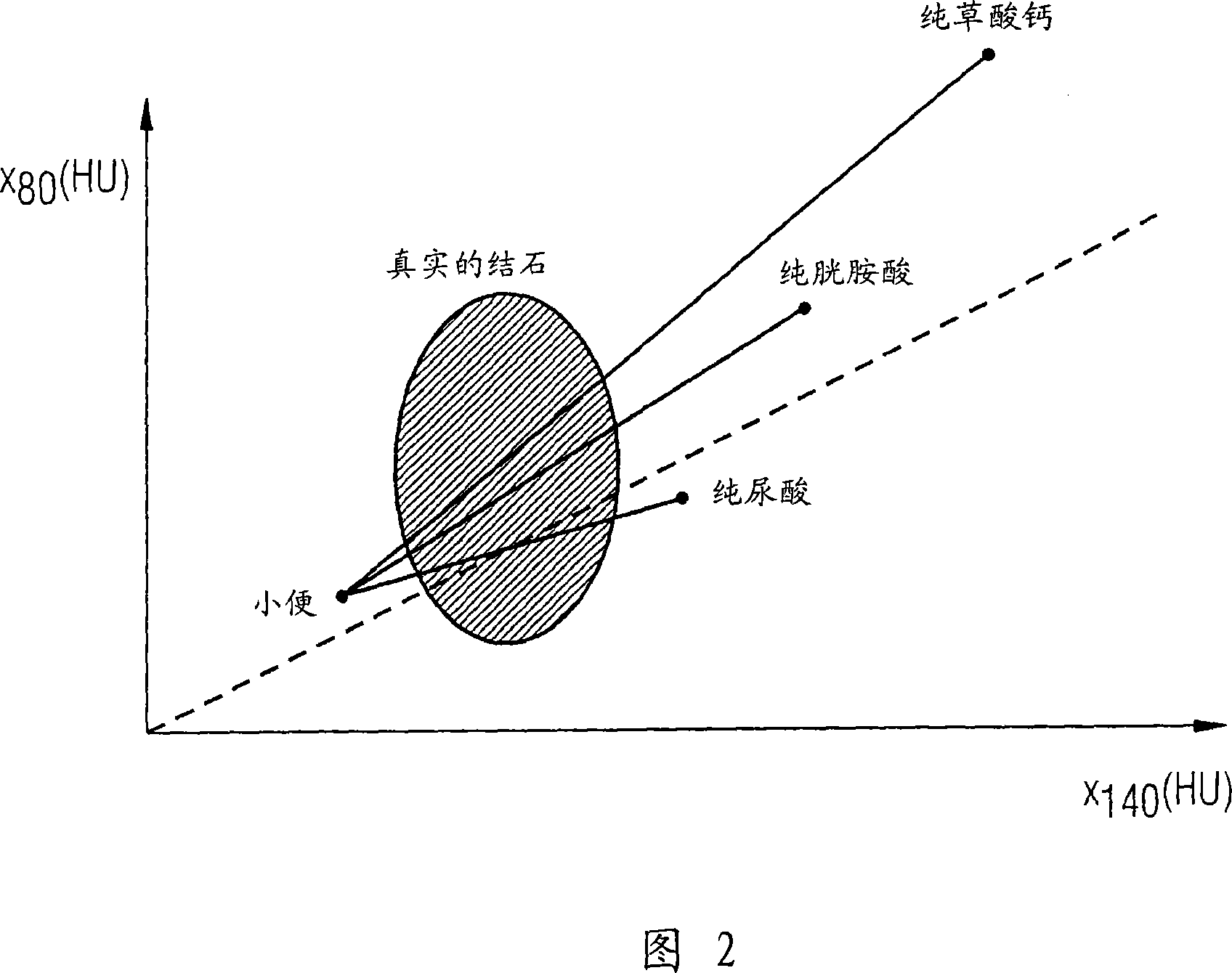 Method and device for automatic distinguishing kidney stone types by computer tomography contrast