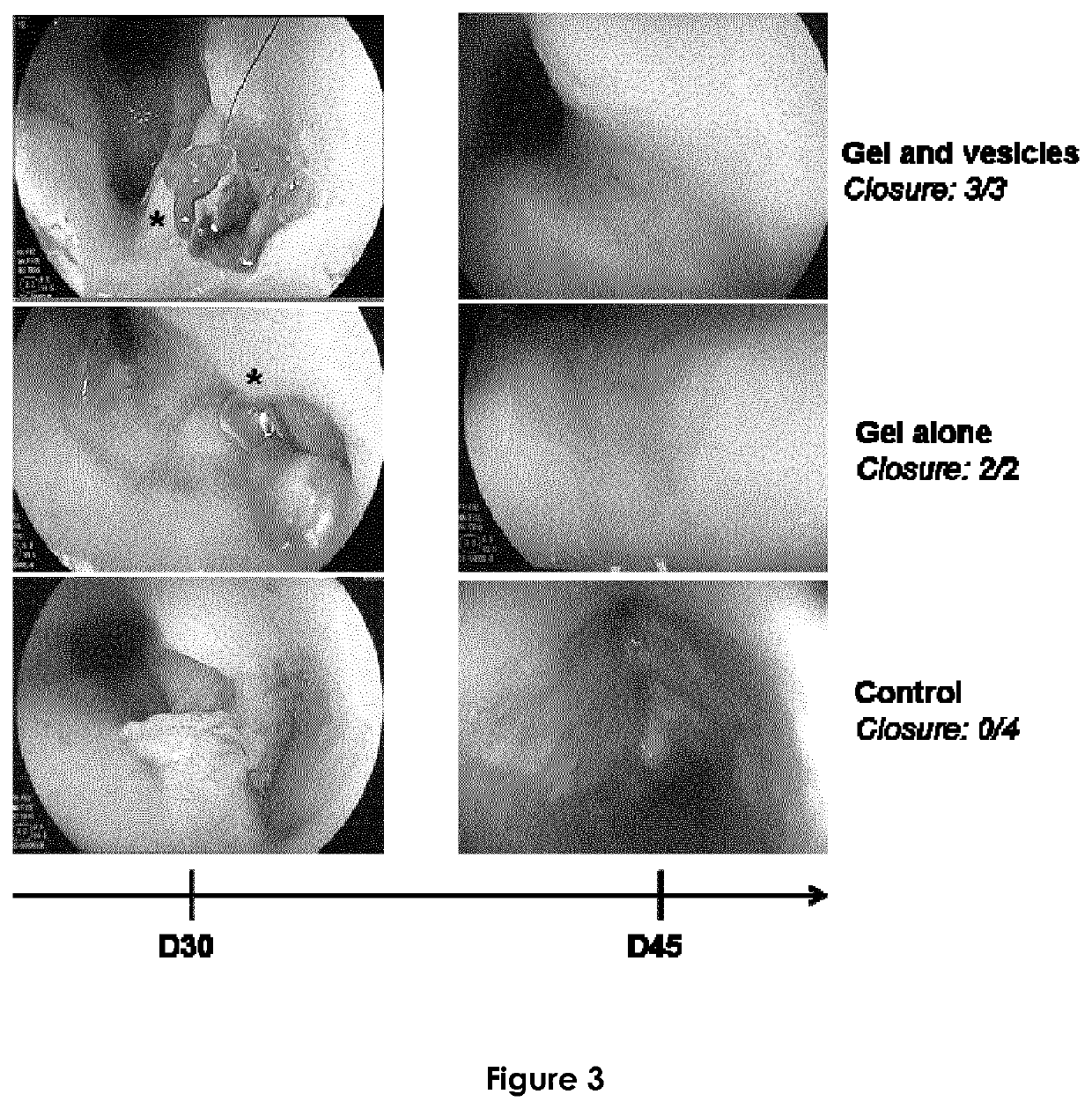 Compositions useful for mucosal healing