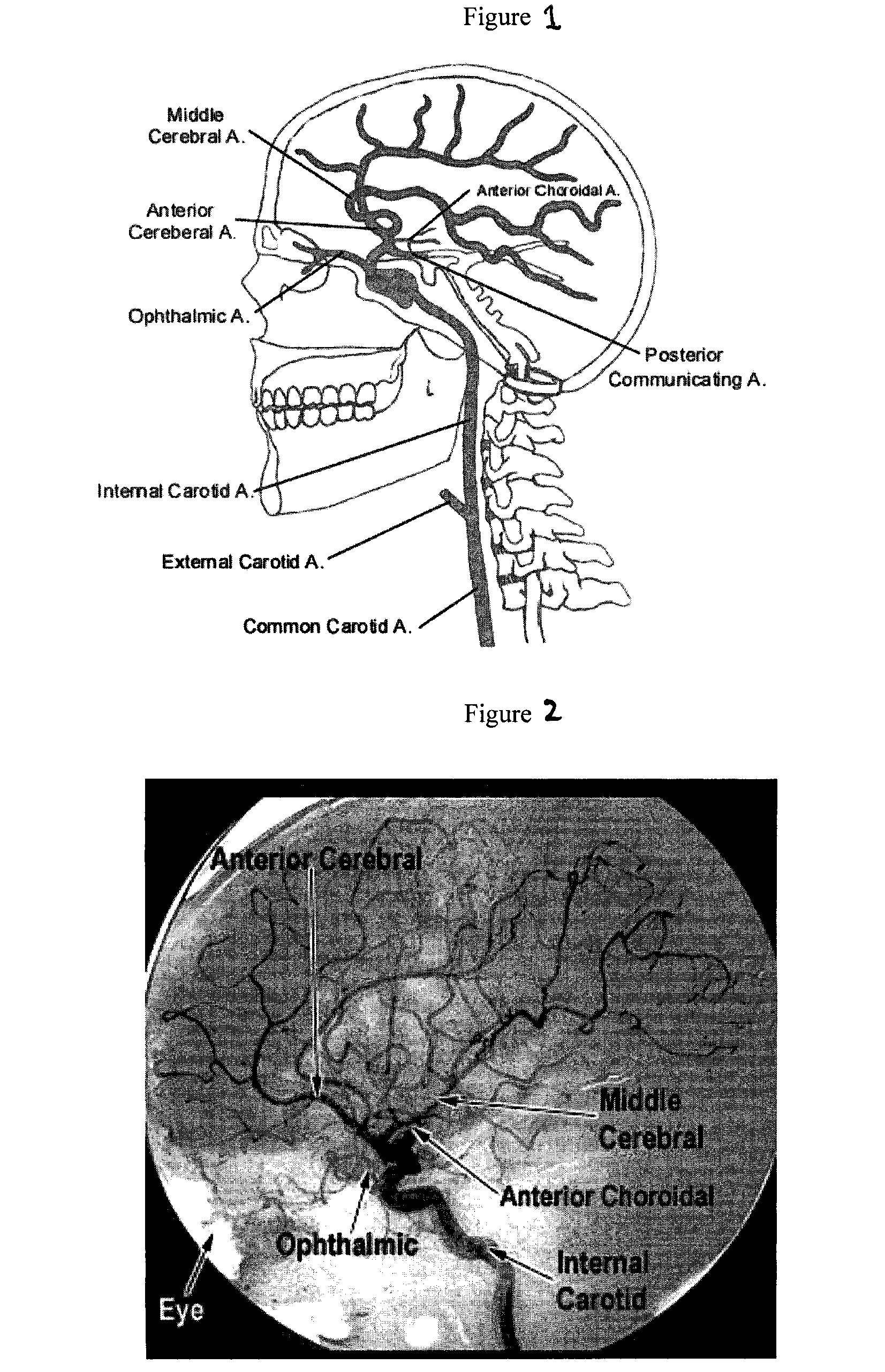 Cerebral and Retinal Perfusion Monitoring Systems and Devices