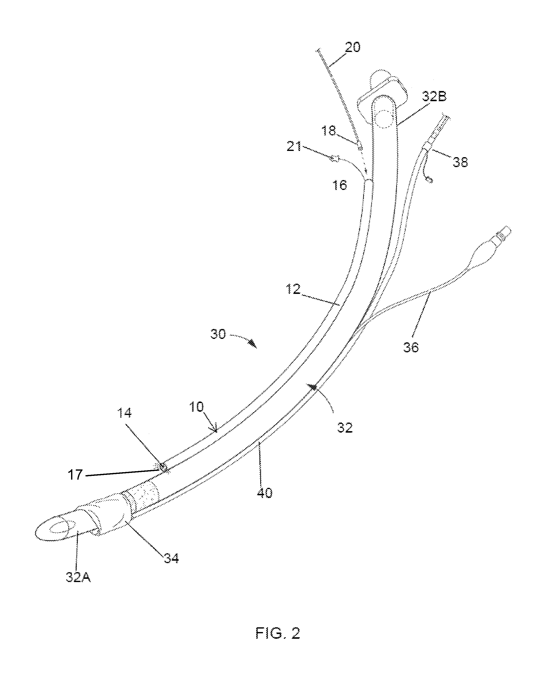 Medical devices and methods of placement