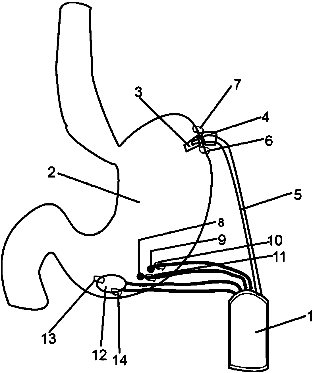 Low-power-consumption small-sized in-vivo implantation type gastric physiological parameter monitoring device and method