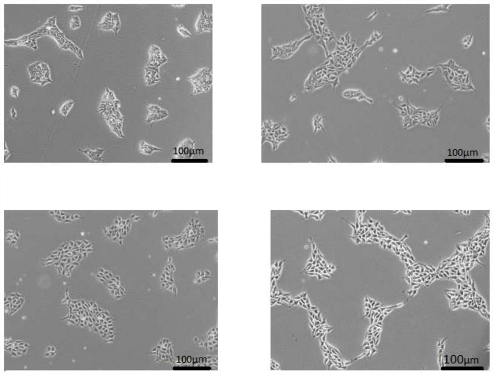 A method for preparing vascular endothelial cells and its special kit