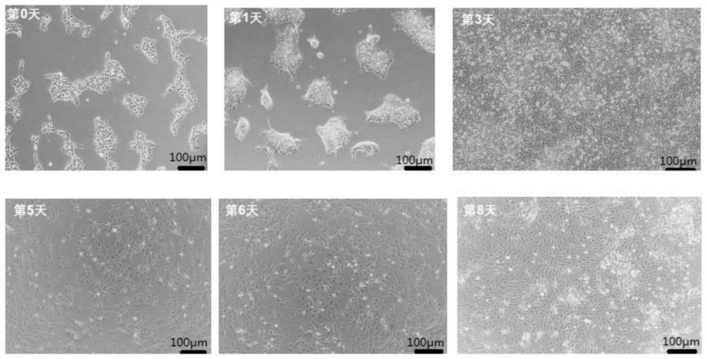 A method for preparing vascular endothelial cells and its special kit