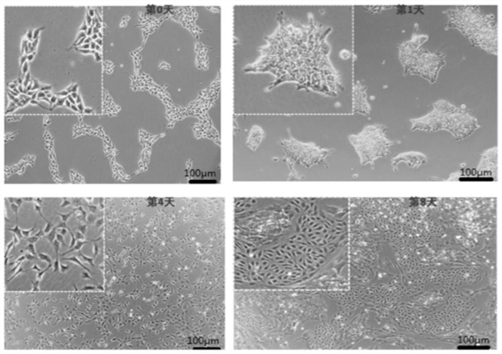 A method for preparing vascular endothelial cells and its special kit