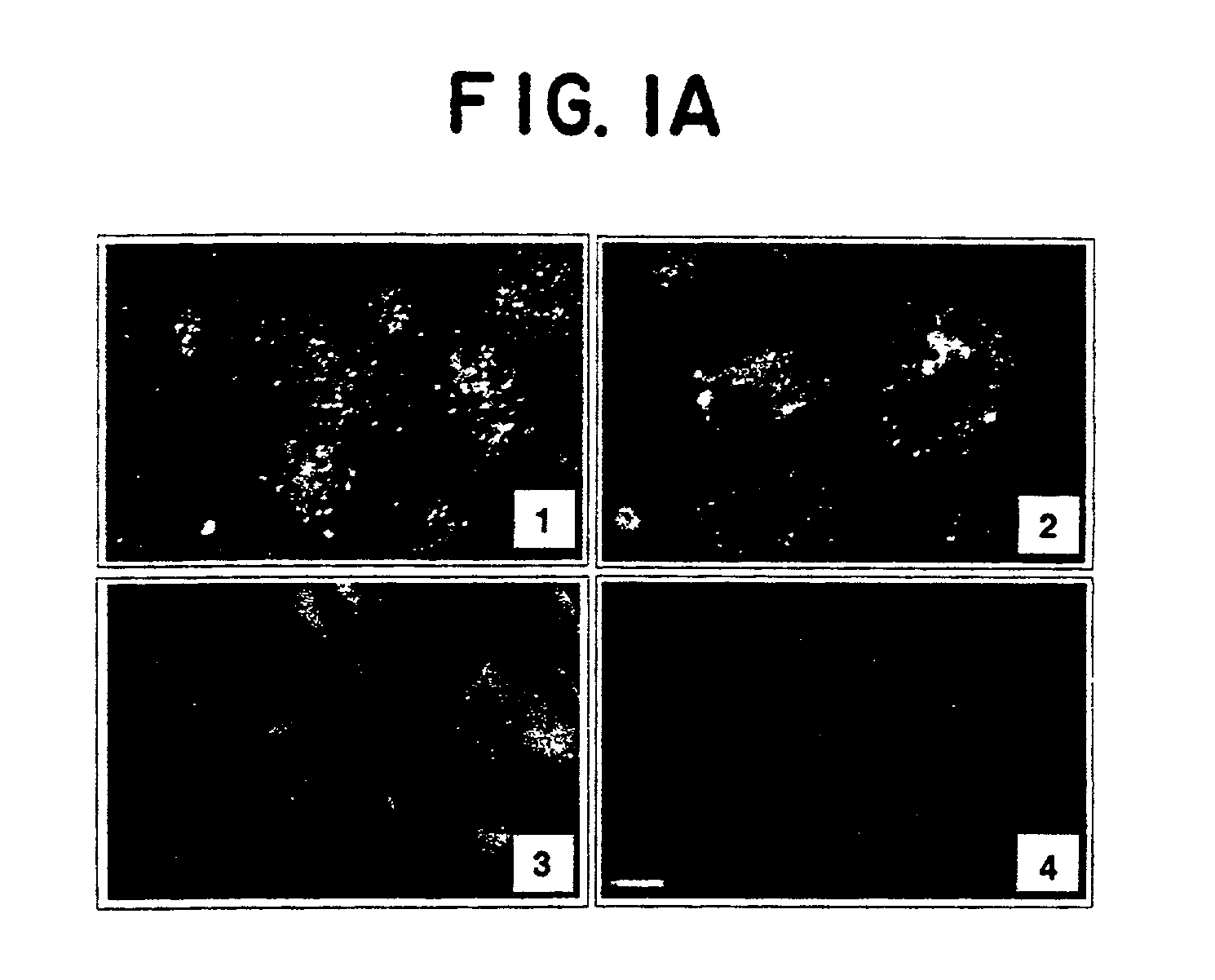 Modulation of angiogenesis and wound healing