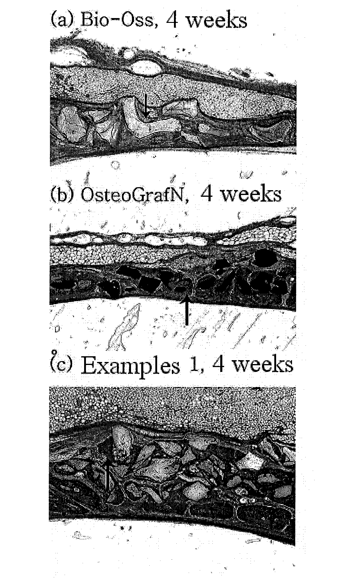 Method for preparing a prion-free bond grafting substitute