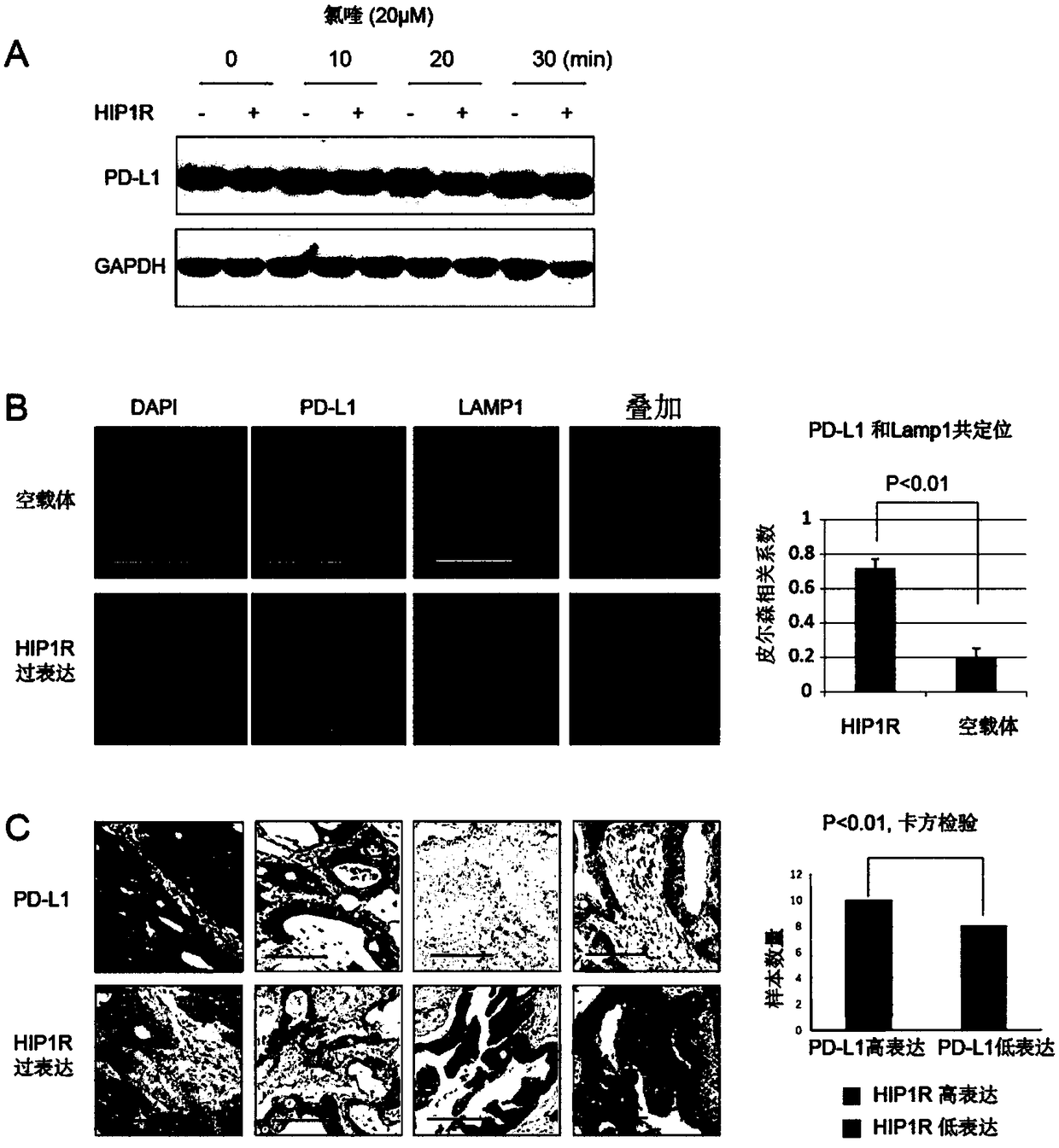 PD-L1 targeting polypeptide and application thereof