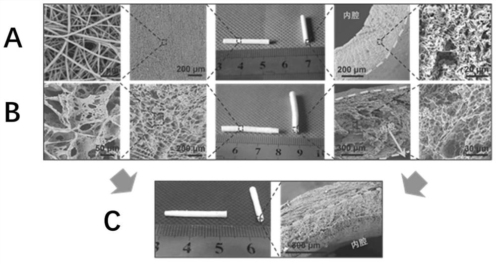 A double-layer artificial blood vessel and its preparation method