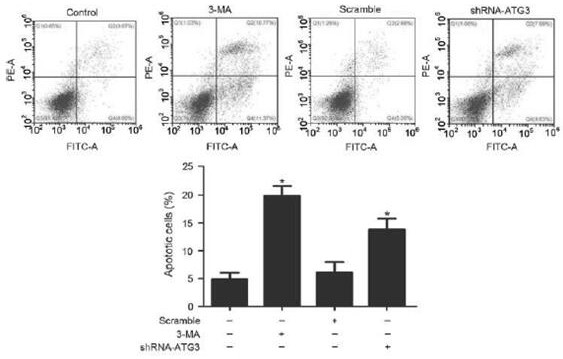 A cisplatin-like drug side effect inhibition or therapeutic target