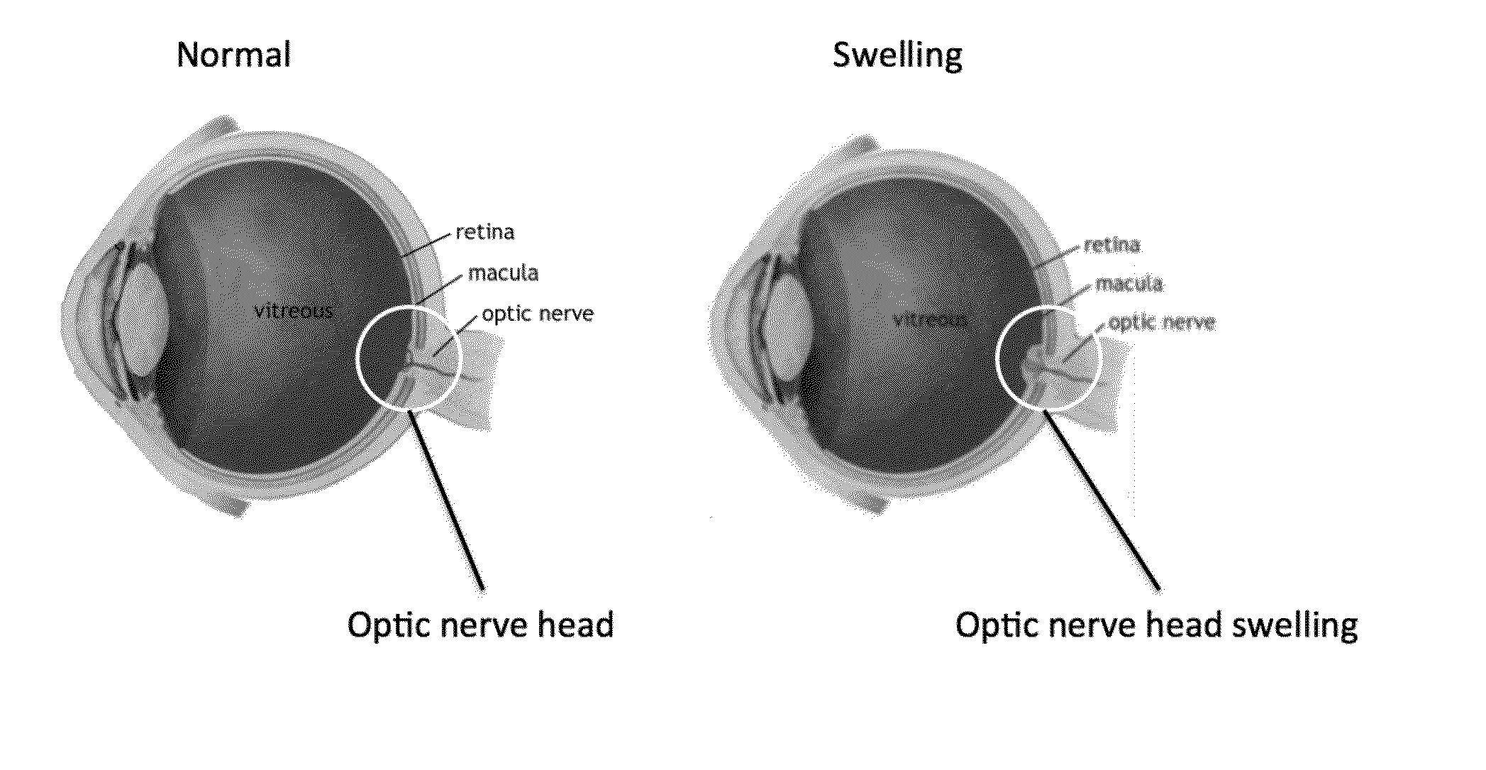 Method and System for Optic Nerve Head Shape Quantification