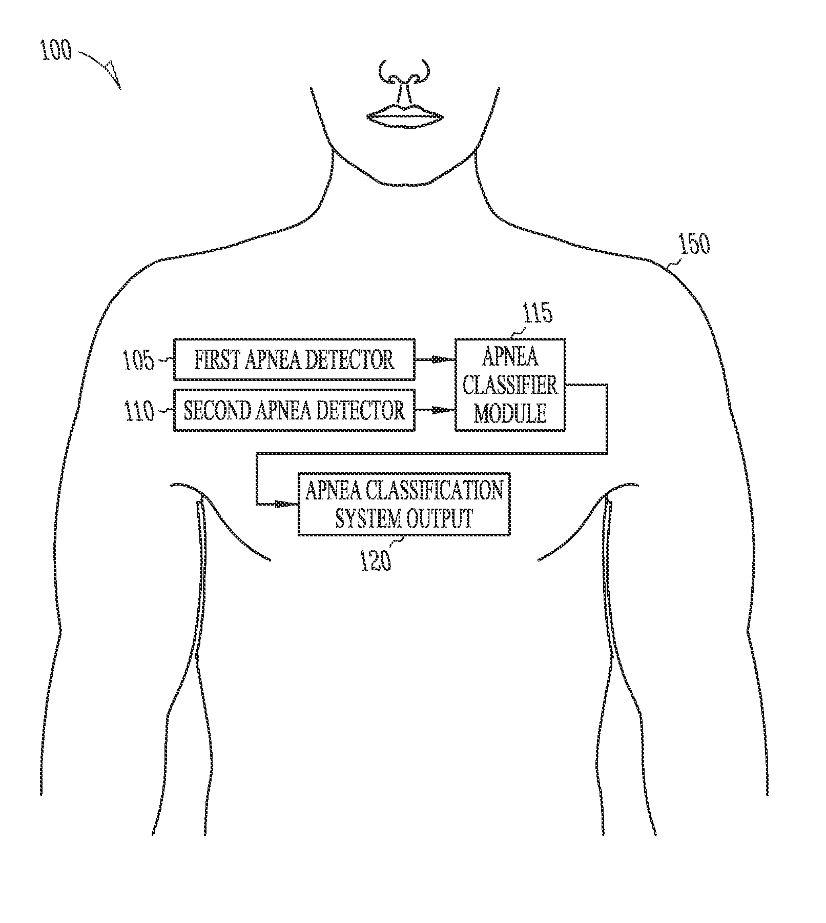 Apnea type determining apparatus and method