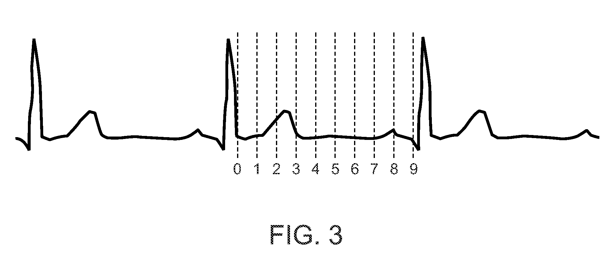 Radiation treatment planning and delivery for moving targets in the heart