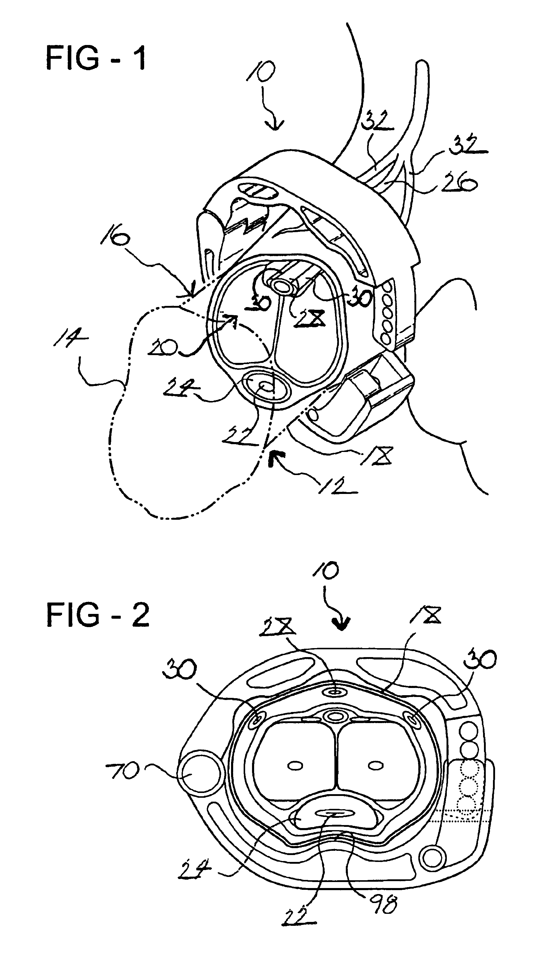 Urinary-control device