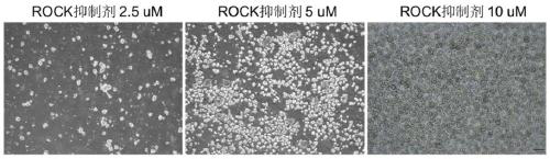 A kind of mesenchymal stem cell and its preparation method and application