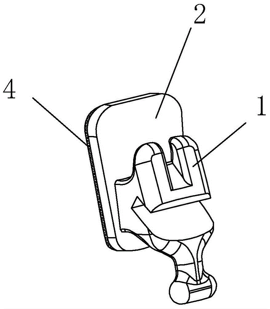 Manufacturing method of customized tongue-side invisible aligner