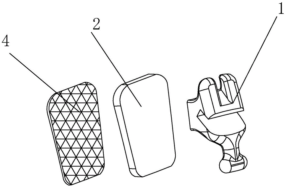 Manufacturing method of customized tongue-side invisible aligner