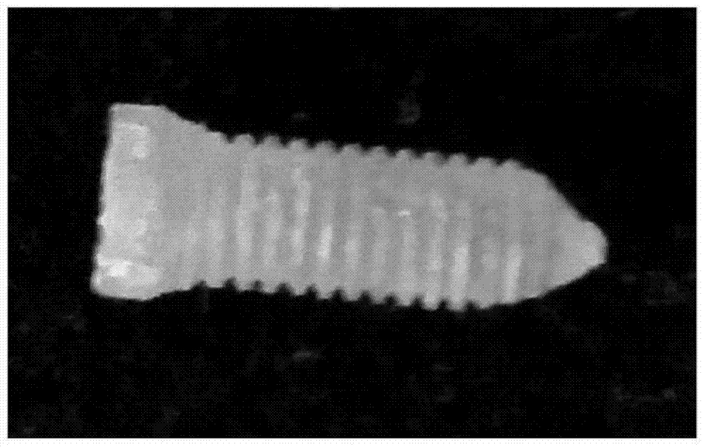 Absorbable orthopedic internal fixation material based on silk fibroin and preparation method thereof