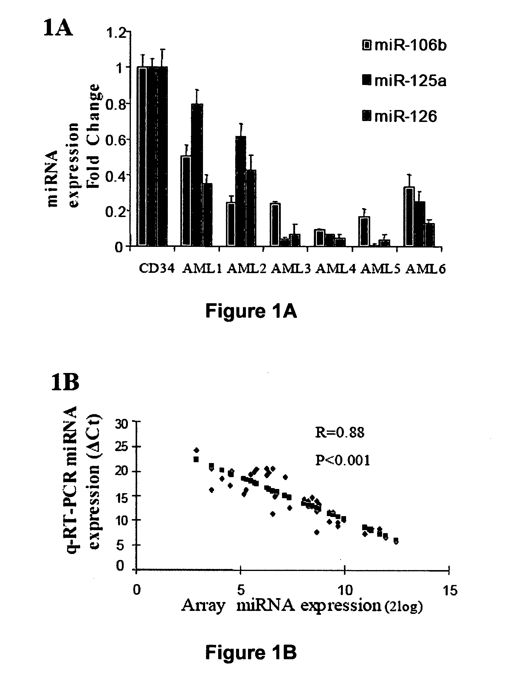 MiR-25-BASED METHODS FOR THE DIAGNOSIS AND PROGNOSIS OF ACUTE MYELOID LEUKEMIA (AML)