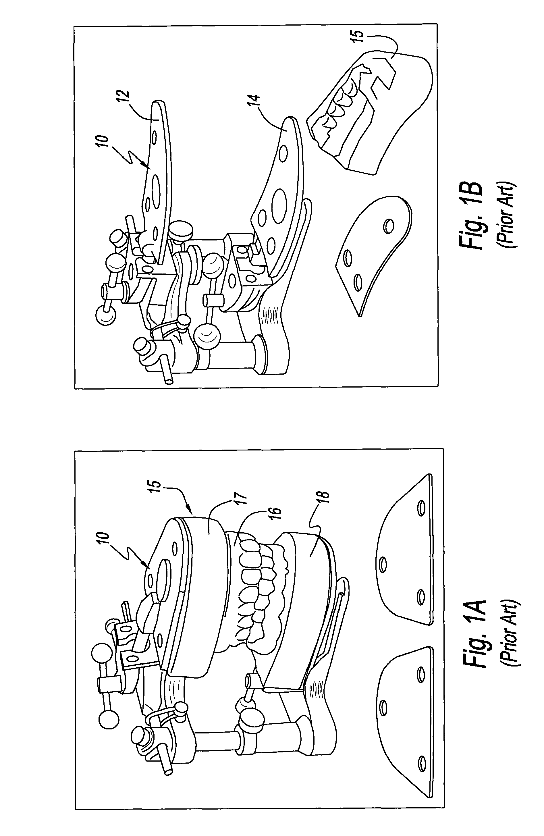 Method and Apparatus for Electronically Modeling and Manufacturing Dentures