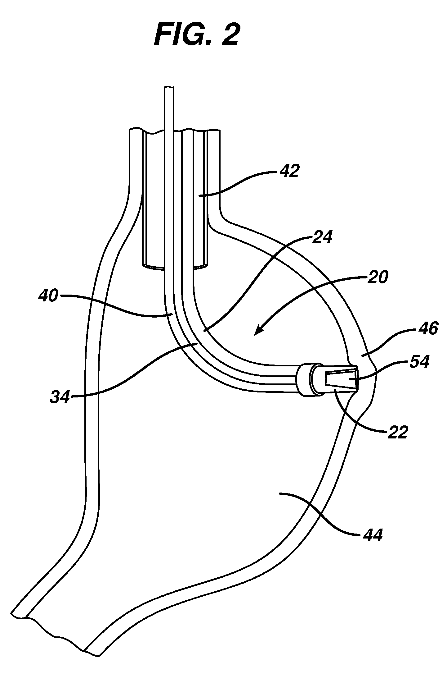 Device for plicating and fastening gastric tissue