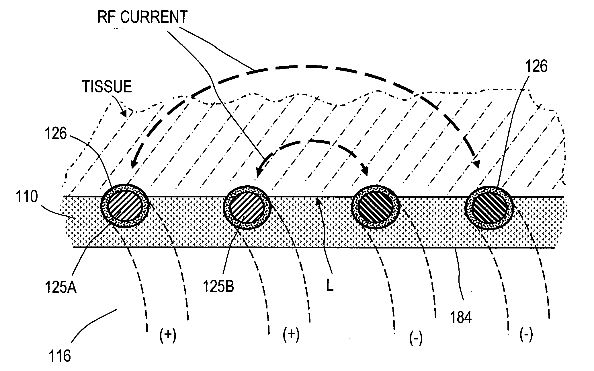 Electrosurgical instrument and method